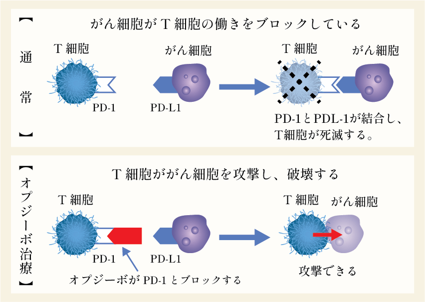 免疫チェックポイント阻害剤によるがん治療